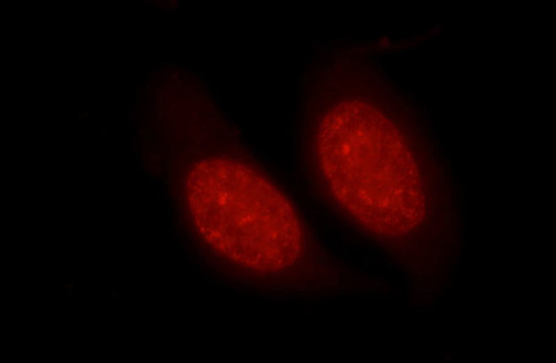 Immunofluorescent analysis of HepG2 cells using Catalog No:111366(Histone H1.0 Antibody) at dilution of 1:50 and Rhodamine-Goat anti-Rabbit IgG