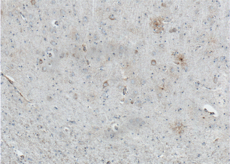 Immunohistochemistry of paraffin-embedded human brain tissue slide using Catalog No:107570(ALDH1A1 Antibody) at dilution of 1:200 (under 10x lens). heat mediated antigen retrieved with Sodium Citrate buffer (pH6).