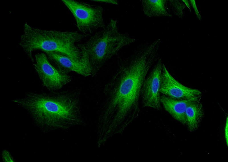 Immunofluorescent analysis of A549 cells using Catalog No:112390(MAGED1 Antibody) at dilution of 1:50 and Alexa Fluor 488-congugated AffiniPure Goat Anti-Rabbit IgG(H+L)
