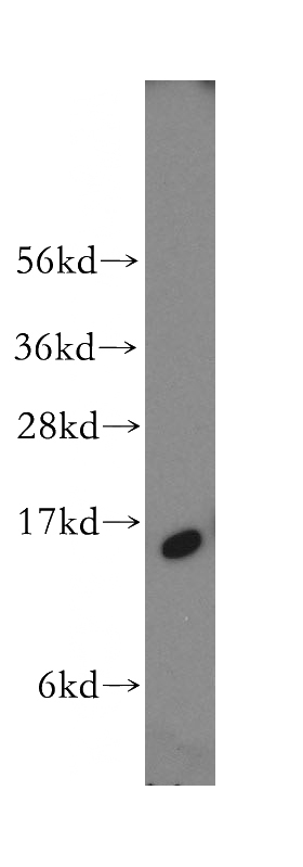 human brain tissue were subjected to SDS PAGE followed by western blot with Catalog No:110441(FABP5 antibody) at dilution of 1:500