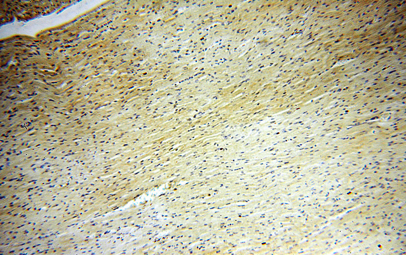Immunohistochemical of paraffin-embedded human heart using Catalog No:112432(MAPK12 antibody) at dilution of 1:100 (under 10x lens)