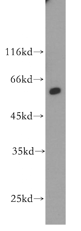 A431 cells were subjected to SDS PAGE followed by western blot with Catalog No:113550(P4HA1 antibody) at dilution of 1:600