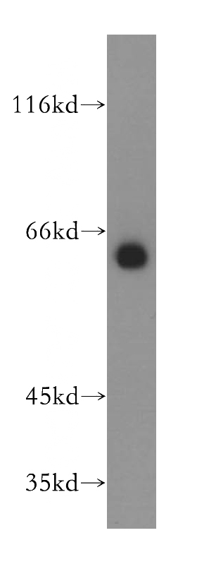 mouse liver tissue were subjected to SDS PAGE followed by western blot with Catalog No:111120(GPR177 antibody) at dilution of 1:400