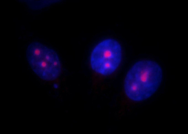 Immunofluorescent analysis of HepG2 cells, using UTP14A antibody Catalog No:116694 at 1:25 dilution and Rhodamine-labeled goat anti-rabbit IgG (red). Blue pseudocolor = DAPI (fluorescent DNA dye).