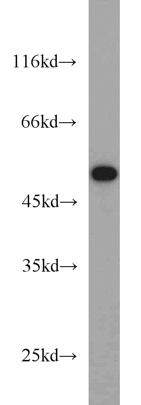 mouse heart tissue were subjected to SDS PAGE followed by western blot with Catalog No:107892(ADRB2 antibody) at dilution of 1:1000