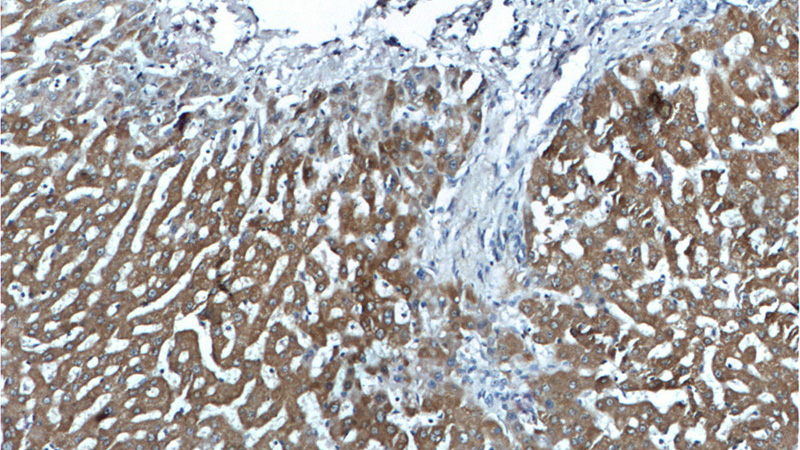 Immunohistochemistry of paraffin-embedded human liver tissue slide using Catalog No:111204(GRHPR Antibody) at dilution of 1:200 (under 10x lens)