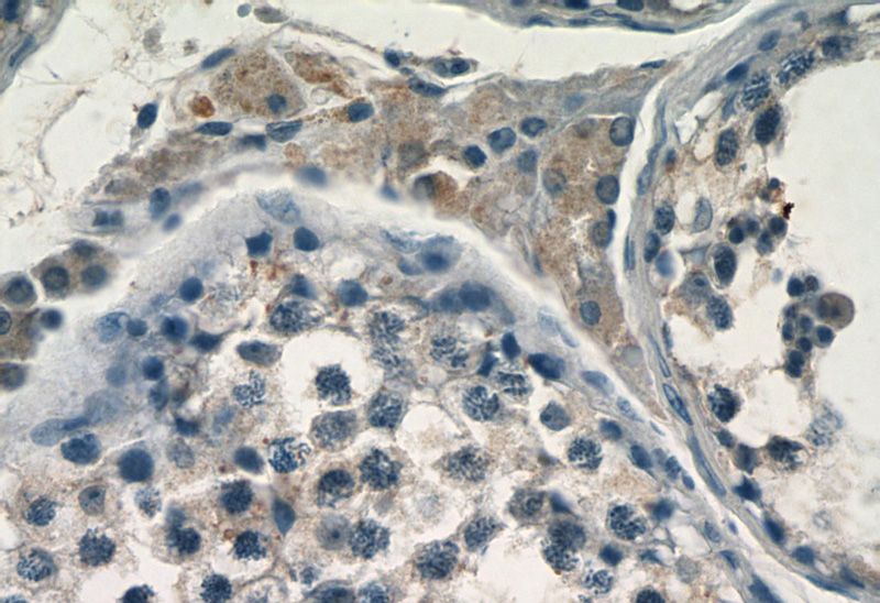 Immunohistochemistry of paraffin-embedded human testis tissue slide using Catalog No:110472(FAM133A Antibody) at dilution of 1:50 (under 40x lens)