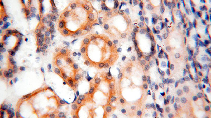 Immunohistochemical of paraffin-embedded human kidney using Catalog No:114782(ROGDI antibody) at dilution of 1:100 (under 40x lens)