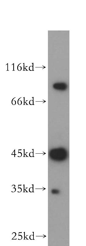 HepG2 cells were subjected to SDS PAGE followed by western blot with Catalog No:112658(MEPE antibody) at dilution of 1:600