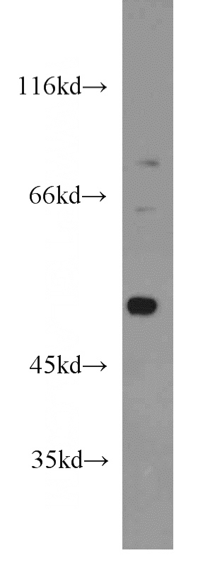 HEK-293 cells were subjected to SDS PAGE followed by western blot with Catalog No:109828(DDX39 antibody) at dilution of 1:1000