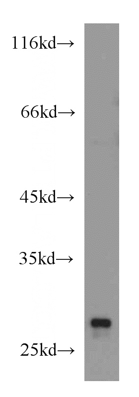 Jurkat cells were subjected to SDS PAGE followed by western blot with Catalog No:114663(ARHGDIA,aGDI antibody) at dilution of 1:1000