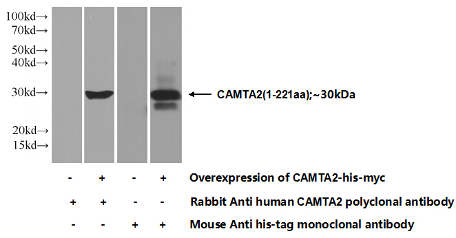 Transfected HEK-293 cells were subjected to SDS PAGE followed by western blot with Catalog No:108929(CAMTA2 Antibody) at dilution of 1:700
