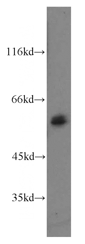 mouse thymus tissue were subjected to SDS PAGE followed by western blot with Catalog No:115890(TBX21,T-bet antibody) at dilution of 1:300