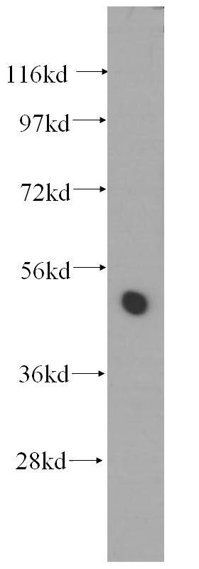 HeLa cells were subjected to SDS PAGE followed by western blot with Catalog No:116386(TTC4 antibody) at dilution of 1:500