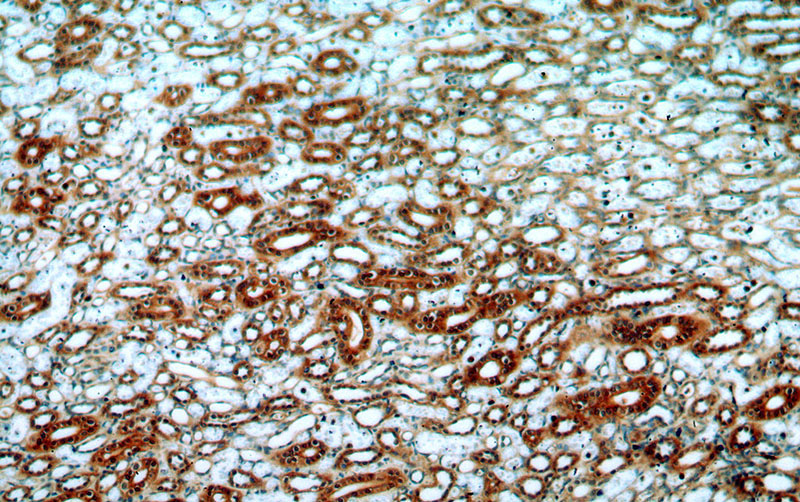 Immunohistochemical of paraffin-embedded human kidney using Catalog No:110592(FAM49B antibody) at dilution of 1:100 (under 10x lens)