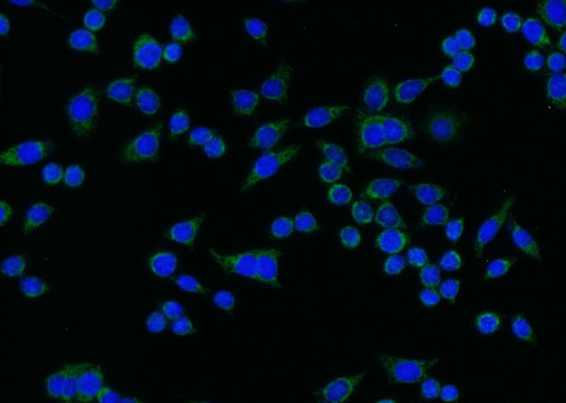 Immunofluorescent analysis of BxPC-3 cells using Catalog No:115490(SocS5 Antibody) at dilution of 1:25 and Alexa Fluor 488-congugated AffiniPure Goat Anti-Rabbit IgG(H+L)
