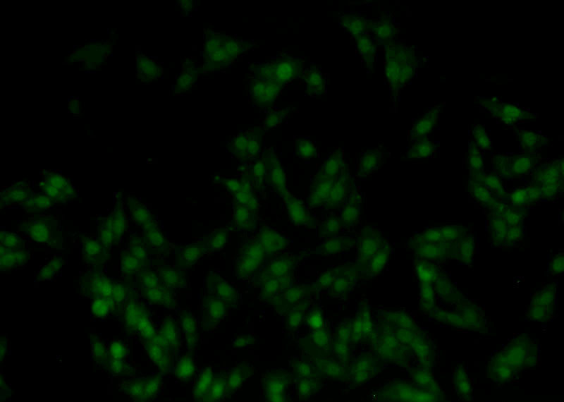 Immunofluorescent analysis of A375 cells using Catalog No:112713(MNAT1 Antibody) at dilution of 1:25 and Alexa Fluor 488-congugated AffiniPure Goat Anti-Rabbit IgG(H+L)