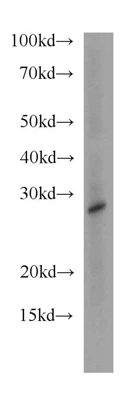 mouse colon tissue were subjected to SDS PAGE followed by western blot with Catalog No:111389(HDHD3 antibody) at dilution of 1:500
