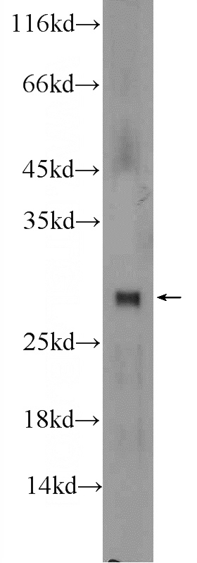 mouse testis tissue were subjected to SDS PAGE followed by western blot with Catalog No:116381(TTC32 Antibody) at dilution of 1:300
