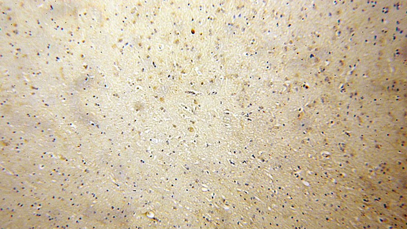 Immunohistochemical of paraffin-embedded human brain using Catalog No:114878(RPL23 antibody) at dilution of 1:50 (under 10x lens)