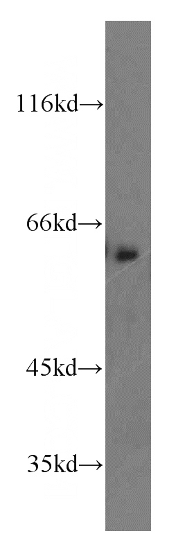 mouse brain tissue were subjected to SDS PAGE followed by western blot with Catalog No:108361(Barkor-Specific antibody) at dilution of 1:500