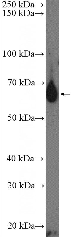 rat thymus tissue were subjected to SDS PAGE followed by western blot with Catalog No:111661(IL13RA2,CD213A2 Antibody) at dilution of 1:300