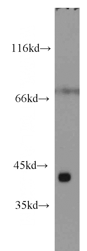 mouse heart tissue were subjected to SDS PAGE followed by western blot with Catalog No:115634(ST8SIA2-Specific antibody) at dilution of 1:400