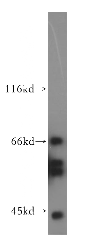 Jurkat cells were subjected to SDS PAGE followed by western blot with Catalog No:113545(P2RY1 antibody) at dilution of 1:500