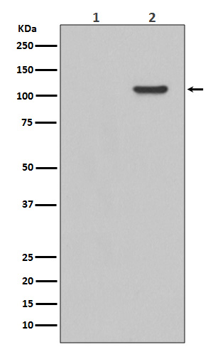 Western blot analysis of Phospho-FAK (Y397) expression in EGF treated 293 whole cell lysates,The lane on the left is treated with the antigen-specific peptide.