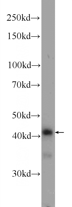 mouse liver tissue were subjected to SDS PAGE followed by western blot with Catalog No:114091(PPP1R7 Antibody) at dilution of 1:600