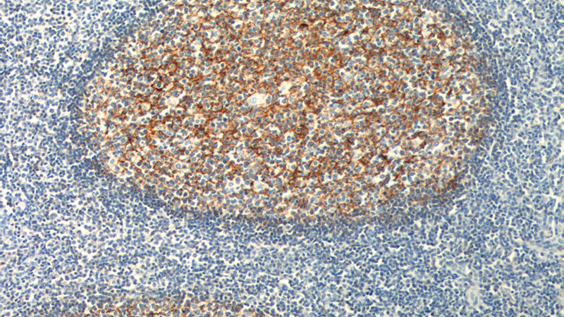Immunohistochemistry of paraffin-embedded human tonsillitis tissue slide using Catalog No:109008(CR2 Antibody) at dilution of 1:200 (under 10x lens). heat mediated antigen retrieved with Tris-EDTA buffer(pH9).