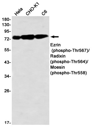 Western blot detection of Ezrin (phospho-Thr567)/ Radixin (phospho-Thr564)/ Moesin (phospho-Thr558) in Hela,CHO-K1,C6 using Ezrin (phospho-Thr567)/ Radixin (phospho-Thr564)/ Moesin (phospho-Thr558) Rabbit mAb(1:1000 diluted)