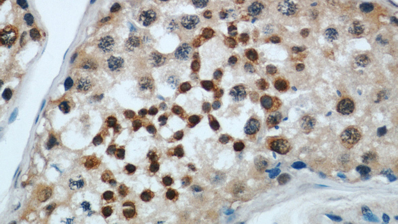 Immunohistochemical of paraffin-embedded human testis using Catalog No:110307(C10orf137 antibody) at dilution of 1:50 (under 40x lens)