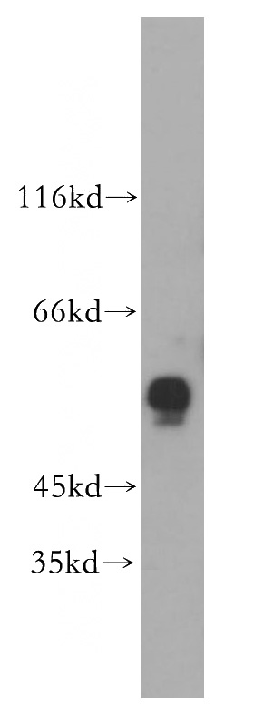 human brain tissue were subjected to SDS PAGE followed by western blot with Catalog No:110370(ERO1LB antibody) at dilution of 1:300