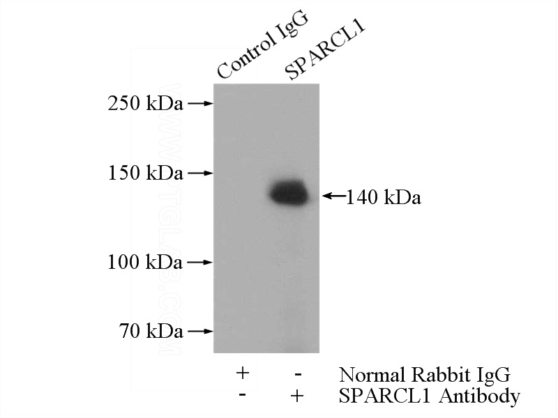 IP Result of anti-SPARCL1 (IP:Catalog No:115544, 4ug; Detection:Catalog No:115544 1:300) with Raji cells lysate 1440ug.
