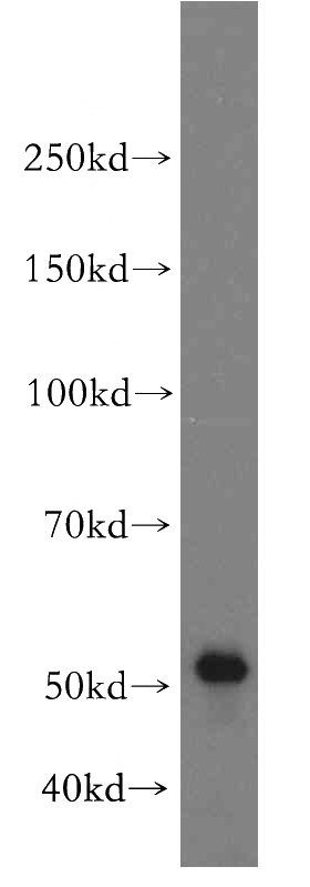 HepG2 cells were subjected to SDS PAGE followed by western blot with Catalog No:109241(CHKA-Specific antibody) at dilution of 1:300