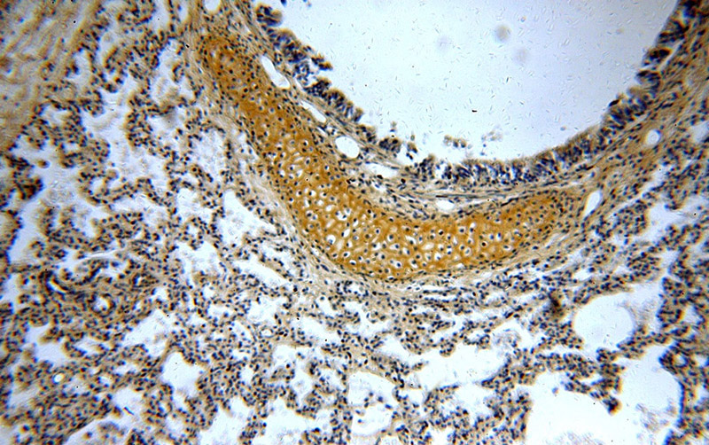 Immunohistochemical of paraffin-embedded human lung using Catalog No:114406(RAB11B-Specific antibody) at dilution of 1:100 (under 10x lens)