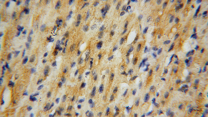 Immunohistochemical of paraffin-embedded human heart using Catalog No:115746(SURF1 antibody) at dilution of 1:50 (under 40x lens)