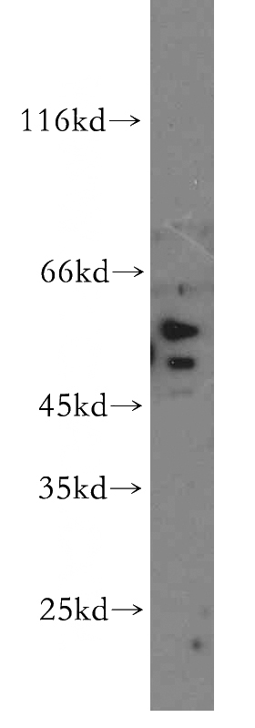 HEK-293 cells were subjected to SDS PAGE followed by western blot with Catalog No:115307(SLC18A1 antibody) at dilution of 1:500