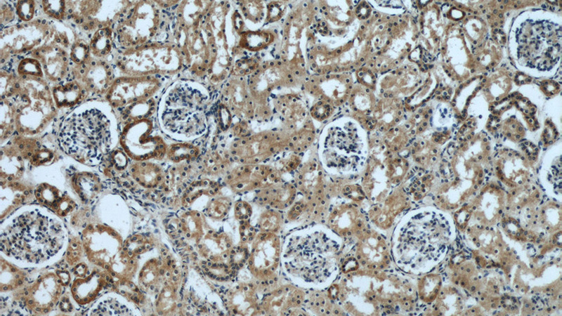 Immunohistochemical of paraffin-embedded human kidney using Catalog No:110420(EYA1 antibody) at dilution of 1:50 (under 10x lens)