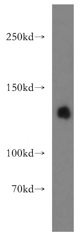 Raji cells were subjected to SDS PAGE followed by western blot with Catalog No:112149(LARS antibody) at dilution of 1:2000