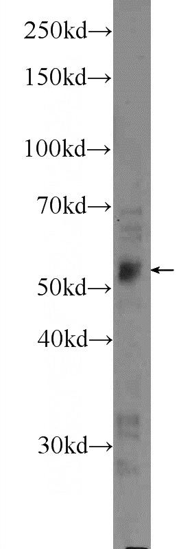MCF-7 cells were subjected to SDS PAGE followed by western blot with Catalog No:112305(LPL Antibody) at dilution of 1:300