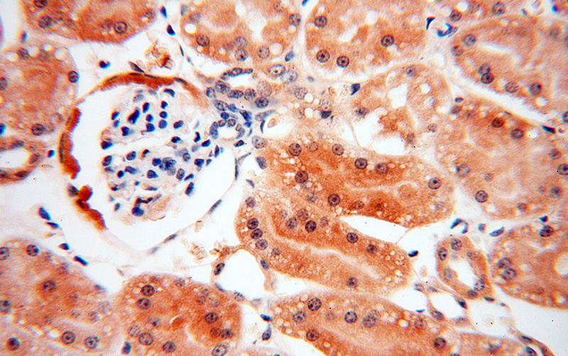 Immunohistochemical of paraffin-embedded human kidney using Catalog No:114500(RABL2A antibody) at dilution of 1:50 (under 40x lens)