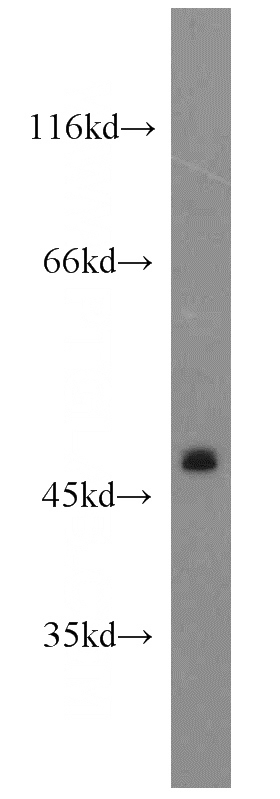 HeLa cells were subjected to SDS PAGE followed by western blot with Catalog No:109350(CLEC18A antibody) at dilution of 1:500