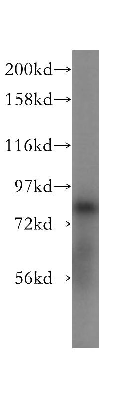 human brain tissue were subjected to SDS PAGE followed by western blot with Catalog No:110575(FAM160B2 antibody) at dilution of 1:500