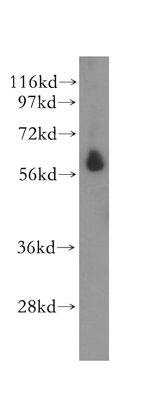 human heart tissue were subjected to SDS PAGE followed by western blot with Catalog No:115719(STK32C antibody) at dilution of 1:500