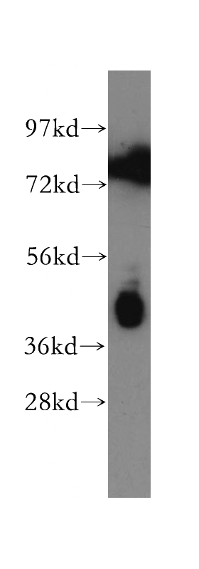 HepG2 cells were subjected to SDS PAGE followed by western blot with Catalog No:113706(PTX3 antibody) at dilution of 1:300
