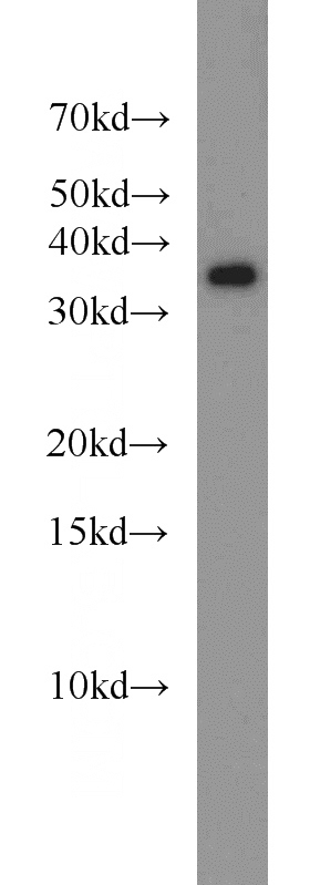 MCF7 cells were subjected to SDS PAGE followed by western blot with Catalog No:112152(LASP1 antibody) at dilution of 1:2000