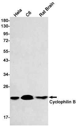 Western blot detection of Cyclophilin B in Hela,C6,Rat Brain lysates using Cyclophilin B Rabbit mAb(1:500 diluted).Predicted band size:24kDa.Observed band size:20kDa.