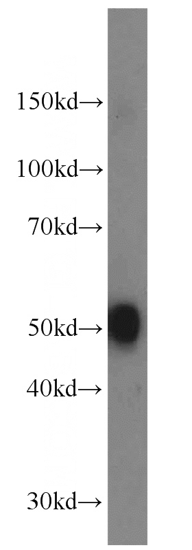 mouse brain tissue were subjected to SDS PAGE followed by western blot with Catalog No:110059(DDC antibody) at dilution of 1:1000